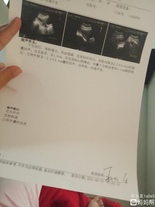 孕八周这样有没有事啊