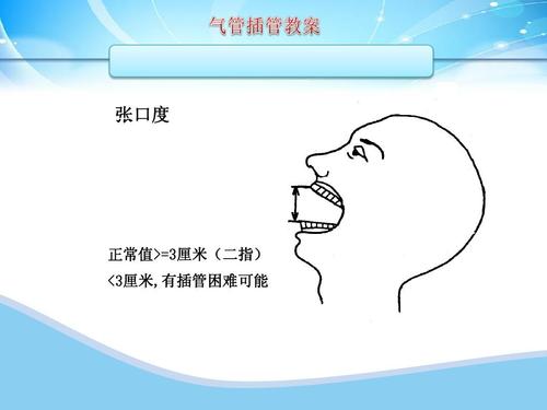 文档网 所有分类 高等教育 医学 气管插管教案ppt  张口度 第6页 (共