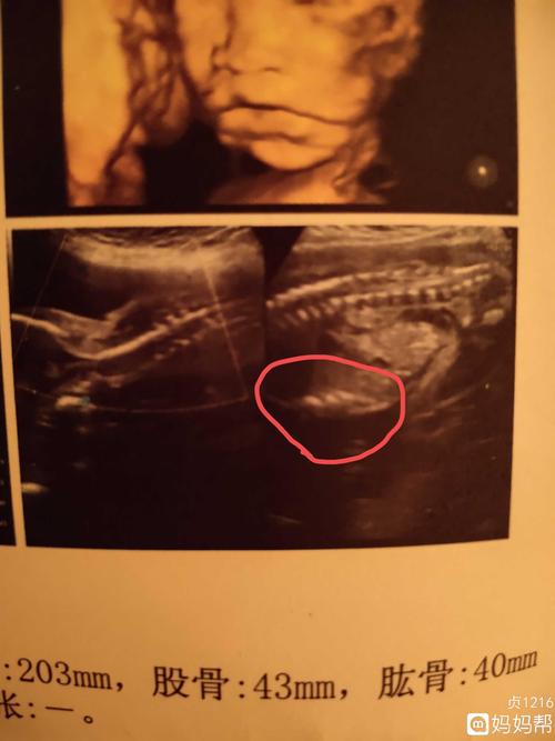 这是传说中的四维三线女宝图吗?这个位置是