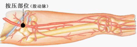 应急救护知识(62)——指压止血法