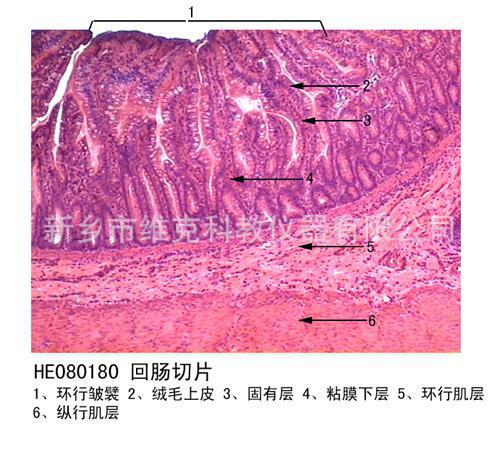 回肠切片