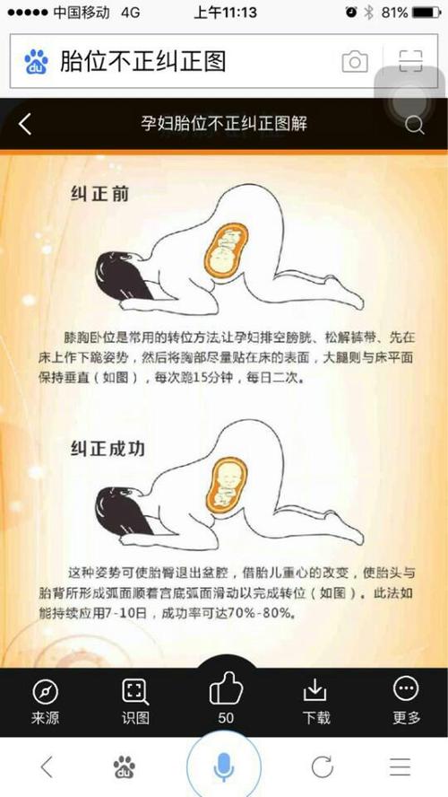 9楼 跪趴   早上晚上睡前各一次每次15分钟  坚持两周