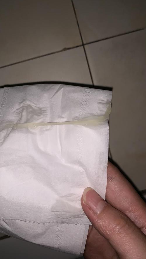 求助,这种白带是什么问题呀?有图慎入