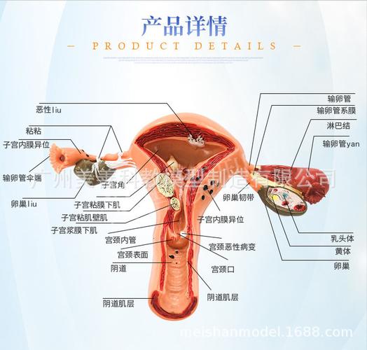 病理子宫模型 女妇产子宫结构解剖 高级仿真病态子宫模型示教模型