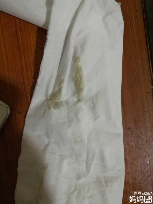 昨晚流出来这个东西是不是宫腔积液里排出