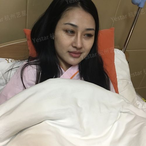 自体脂肪隆胸 项目分类:胸部整形 隆胸 自体脂肪隆胸
