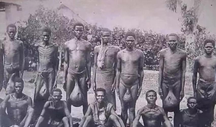 到底丁丁多短才算短小蛋蛋小性激素的分泌会受影响吗