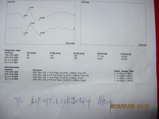 视觉诱发电位 有图帮我看看 谢谢