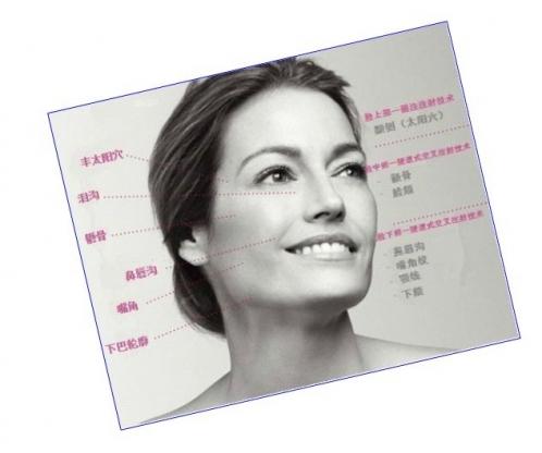 聚左旋乳酸丰面颊专家解答解除疑虑