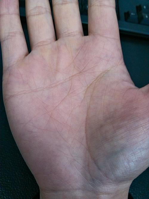 帮我看一下.我是属于两条智慧线还是智慧线中断了?