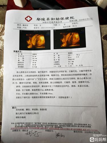 四维彩超查了五次才过,检查宫腔黏连,医生让28周