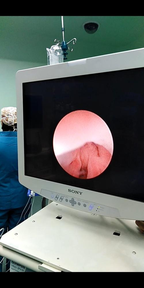 尿道外口开口到阴道,12点为尿道口.