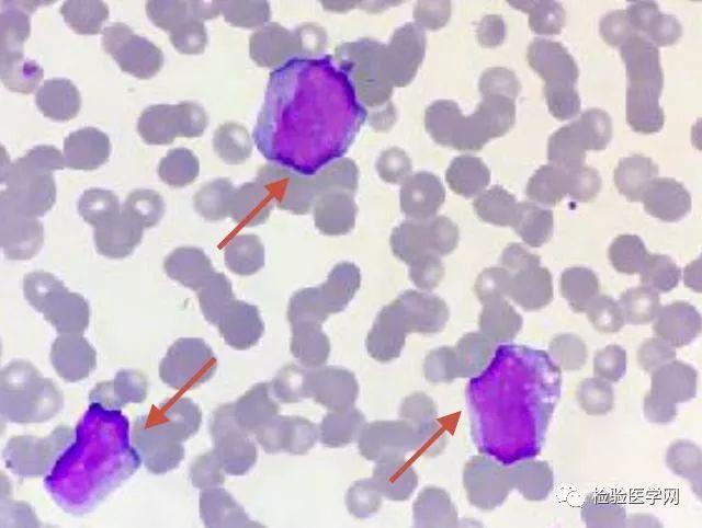 单核细胞-外周血中的百变咖