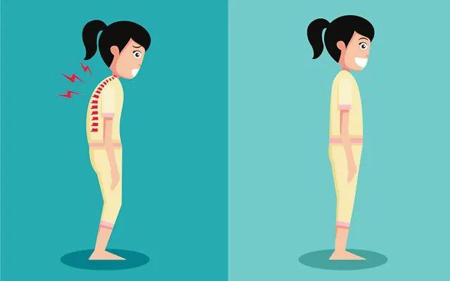 驼背高低肩高发姿势不良or脊柱侧弯