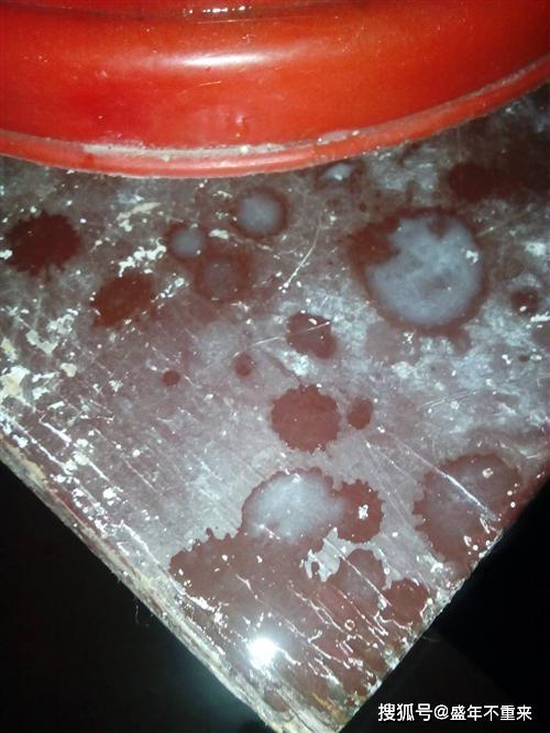 排尿时出现很细小,久久不散的泡沫,需提高警惕啦