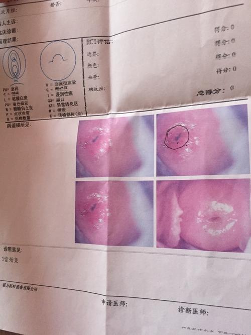 07:34    浏览  33333  推荐回答 你好啊,你怀孕了,轻度宫颈糜烂不用