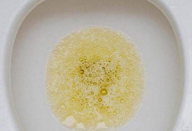 男性晨起"第一次解手",若满足这3种情况,说明肾杠杠的