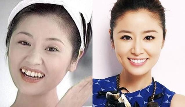 原创6位整过牙的女星她没整之前更可爱最后一位犹如脱胎换骨