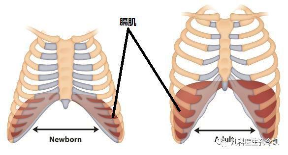 肋骨外翻是什么与缺钙有关吗