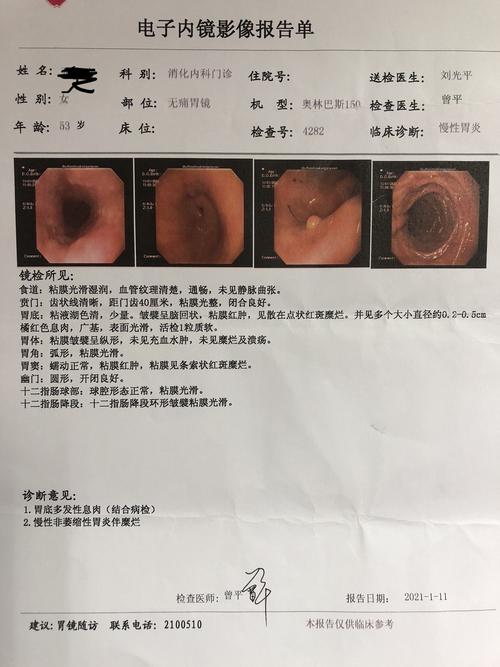 术前胃镜检查结果