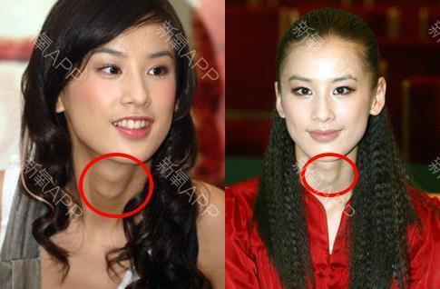 红毯狂魔黄圣依,出道之初以小公举示人,后渐行渐远,冷峻之余,自配喉结