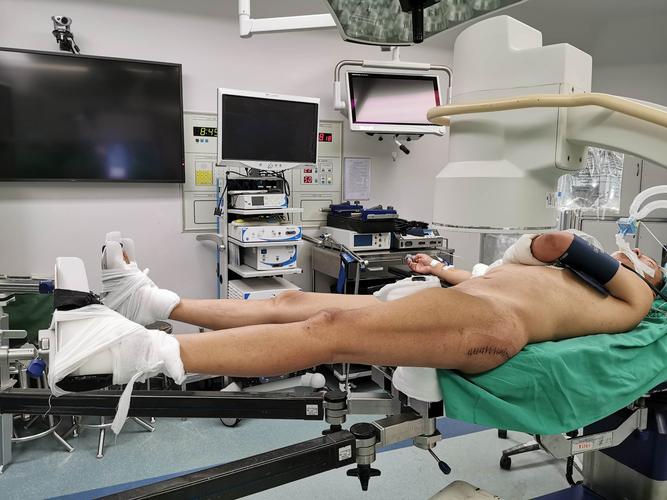 0603髋关节镜手术…吴关