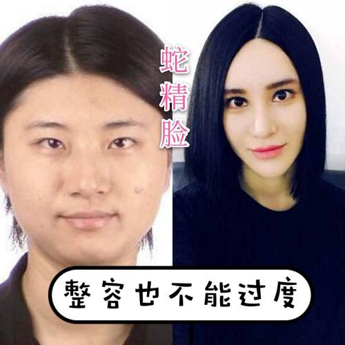 现在的尚雯婕,被网友称为"蛇精脸",对比以前《超级女声》的时候,真是