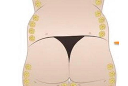 生完孩子后臀部巨难看该怎么呀