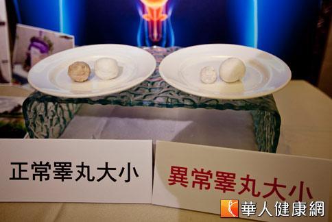 《快问快答》睾丸一大一小坏东西?