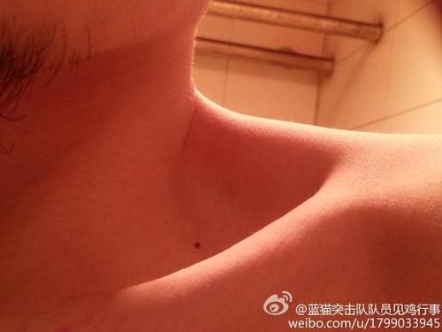 谁能帮我解释一下锁骨有痣是啥意思 谢谢?