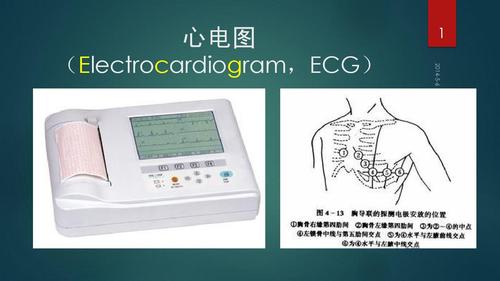 心电图 (electrocardiogram,ecg)