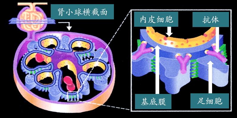 探针资本_行业研究:抗肾小球基底膜病