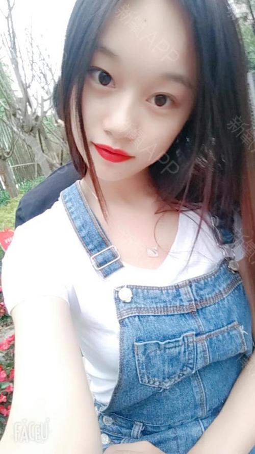 丹丹大表姐小阴唇手术第37天美丽日记