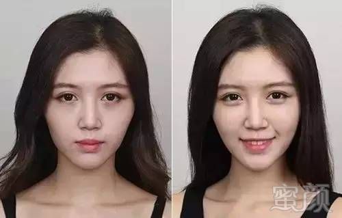 42岁的林志玲--有了苹果肌美哭了!