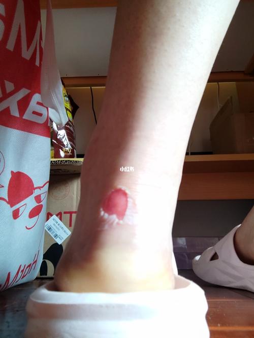 磨破脚后跟后续_上海师范大学(奉贤校区)自由行热门攻略_生活记录_接