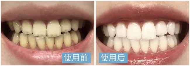 "人没老,牙却坏掉了":做好这点,牙口好,吃嘛嘛香
