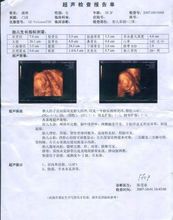 1.医院彩超报告单打印