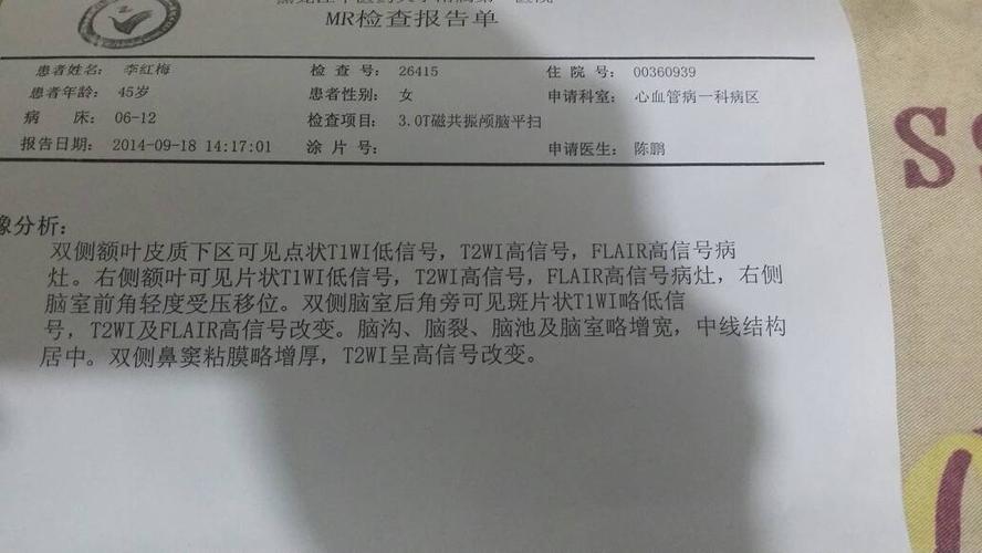 默认排序|1条回答  1 分钟前 |来自|八级 双侧额叶脑梗塞,轻度脑萎缩