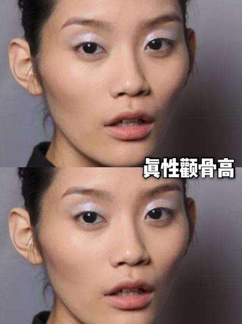 99如何分辨,是颧骨高还是太阳穴凹陷?