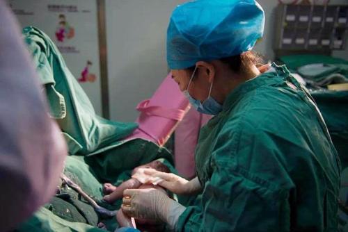 在顺产时进行侧切会影响夫妻恩爱生活吗医生给出这样答案