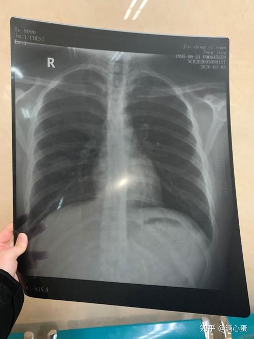 肺片还可以,很清楚