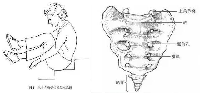 别再头脑发热效仿谷爱凌了你可知滑雪的尽头是骨科
