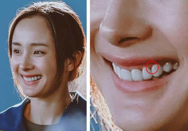 砖家研究 | 如何用肉眼识别明星的假牙?