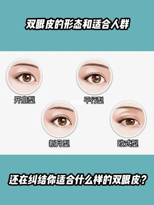 通常双眼皮大致分为4种95