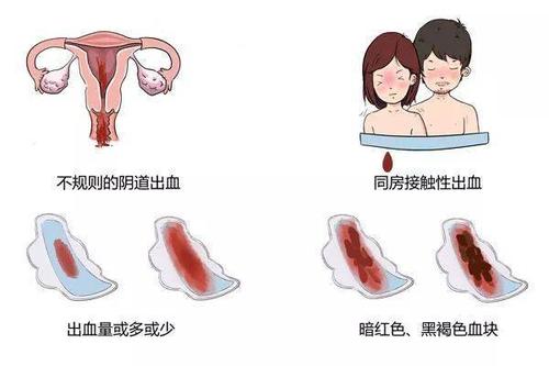 宫颈糜烂普遍怎么治疗呢