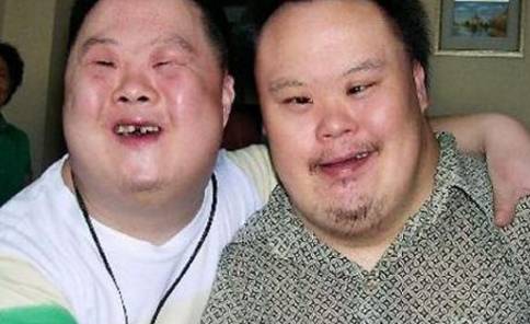 唐氏综合症的方式比较准确而且伤害较那个被称音乐天才的唐氏儿现状