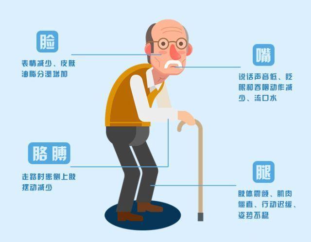 【疾病科普】哪些症状可能是帕金森病症状?