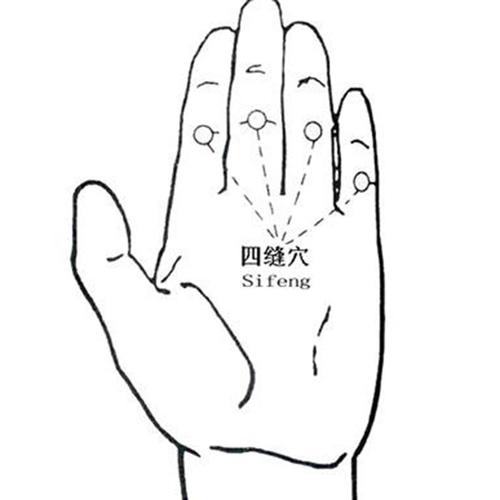 儿科采用针刺四缝穴治疗小儿脾胃病
