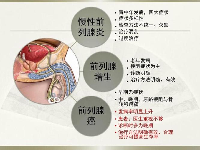 前列腺癌病因及治疗