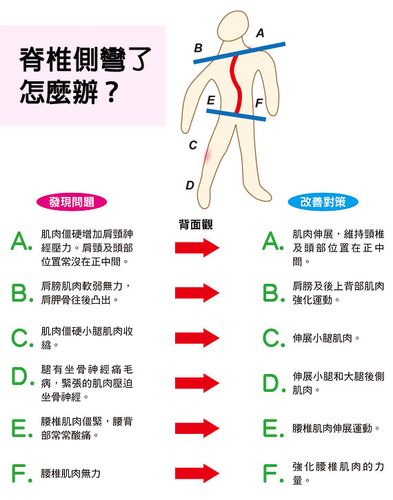 脊柱侧弯重疾理赔 脊椎侧弯手术商业保险能报不